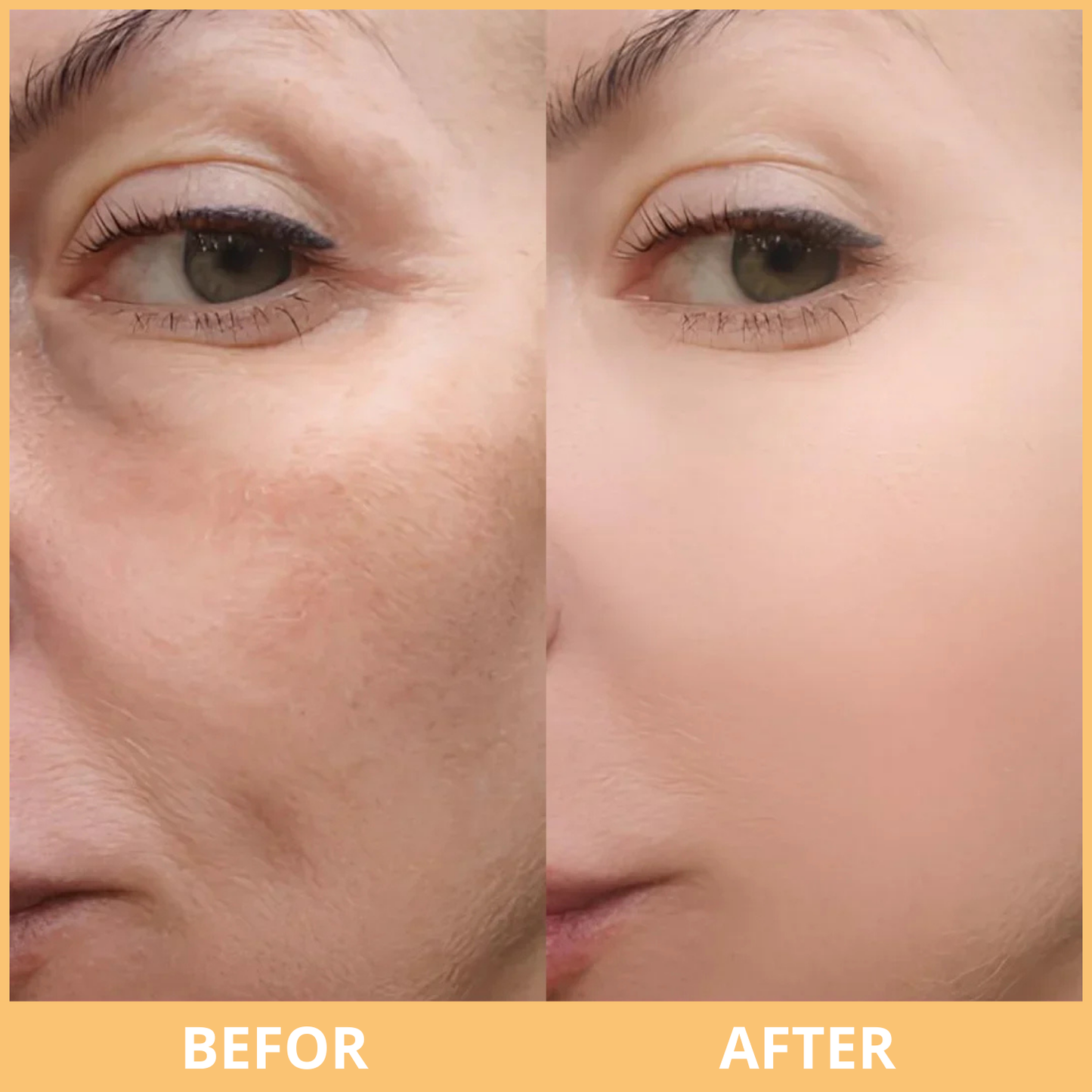 Peel Shot Glow Rice Ampoule Duo by MELAO BEAUTY